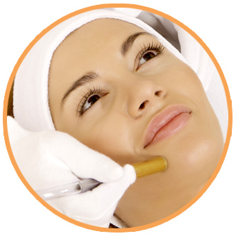Microdermabrasion Microdermabrasion